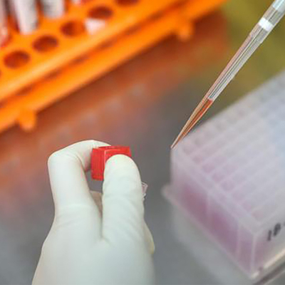Καταχωρημένη CE Monkeypox κολλοειδής χρυσή υψηλή ακρίβεια εξαρτήσεων δοκιμής αντιγόνων ιών γρήγορη